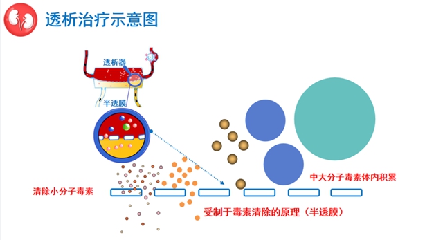 尿毒癥患病率高達(dá)萬分之9左右！該如何保護(hù)你的腎？(圖3)