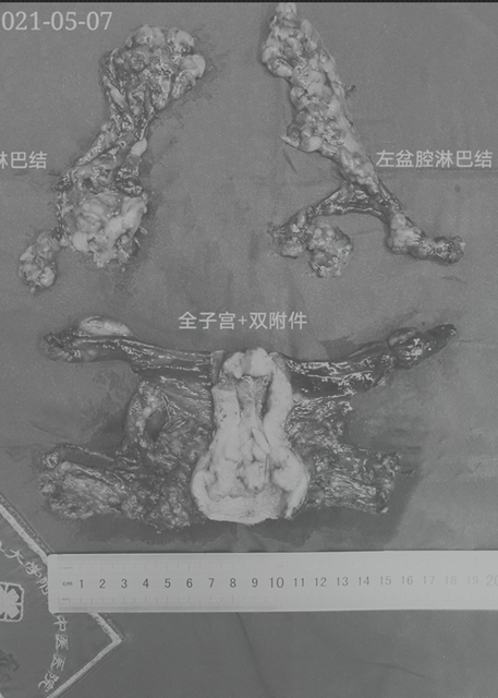 【人物】靠技術(shù)圈粉的婦科男醫(yī)生(圖4)
