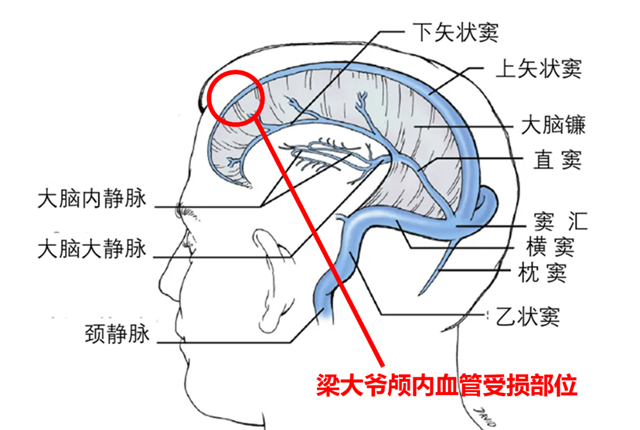 樹3.png