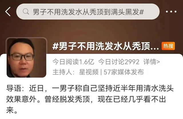 【圍觀】清水洗頭，反而不脫發(fā)了？