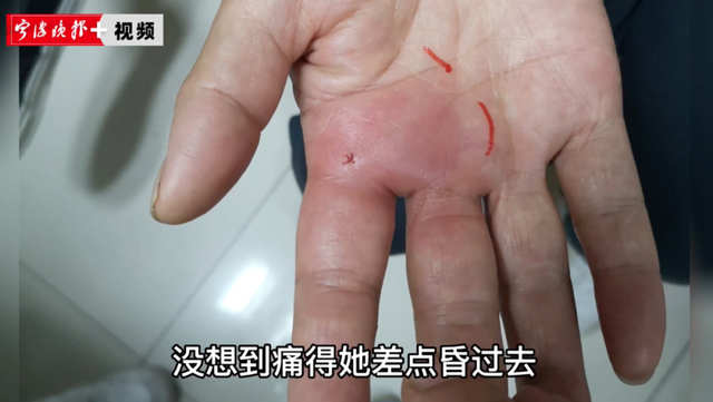 【提醒】擴(kuò)散！這種魚，有毒！