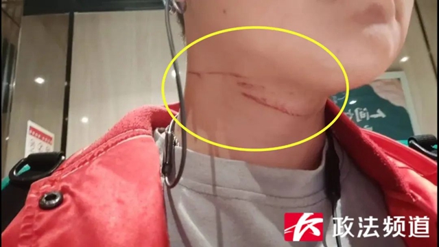 【分享】有人險遭割喉！千萬小心這根“奪命”線