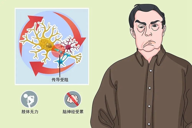 【罕見病】多為急性發(fā)病，面癱也會(huì)致命！