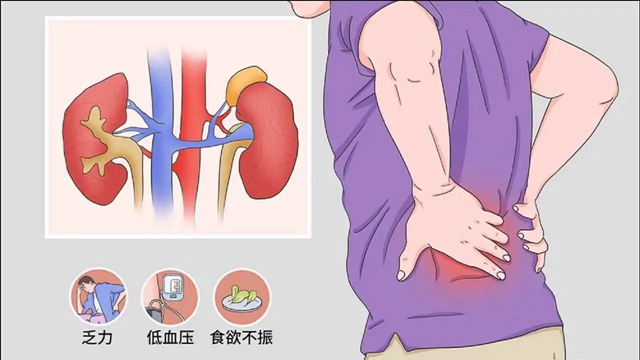 【警惕】惡心嘔吐，男人的腎出問(wèn)題了！