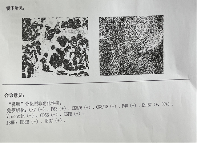 【圍觀】僅三個月，腫瘤就消失了，癌癥有那么可怕嗎？