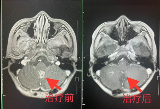 【擴(kuò)散】2名瀘州孃孃腦殼長“包”？