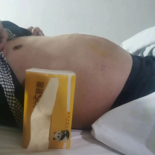 【圍觀】服下毒藥，瀘州男子一晚上拉了60次......