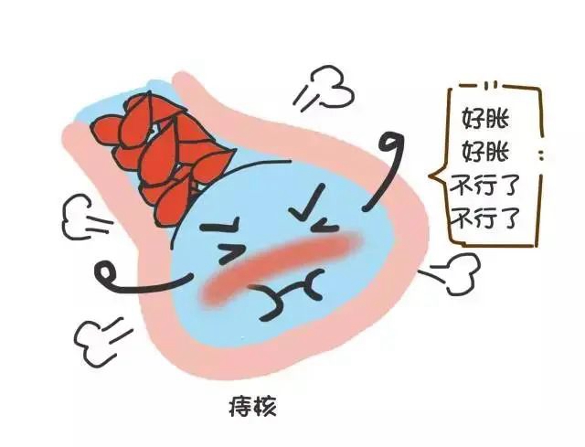 【關注】瀘州一初中生一個痔瘡引發(fā)嚴重貧血，暈倒在廁所！