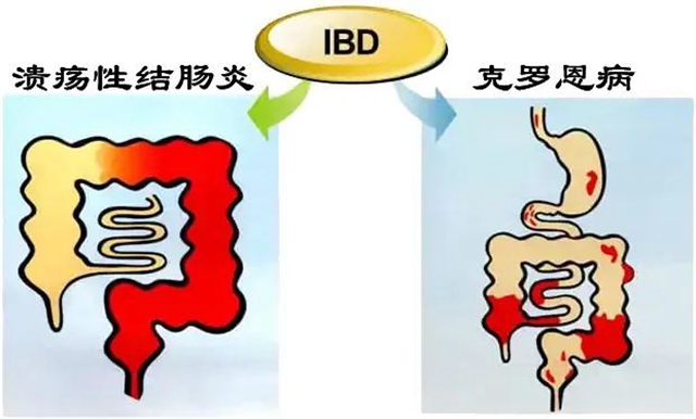 號(hào)稱“不死的癌癥”，看看中招沒(méi)有？