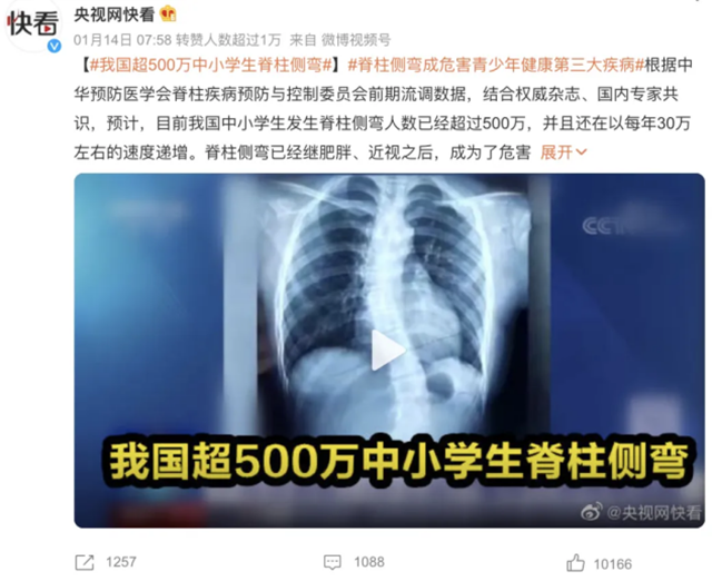 孩子彎腰駝背O型腿？抓住關(guān)鍵時期，還能矯正！