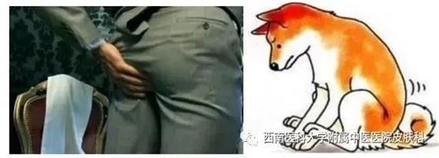 【警惕】大腿根癢得不得了，別撓了，要傳染……