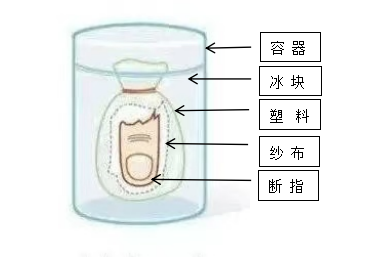 【專科技術(shù)】驚心！又是電鋸！裝修師傅們千萬要小心了！