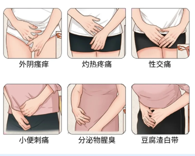 “破案了”，婦科炎癥是這么來(lái)的