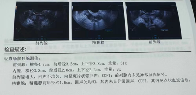 【擴散】男子36歲就中招！一個習(xí)慣，讓這種病提前20年？