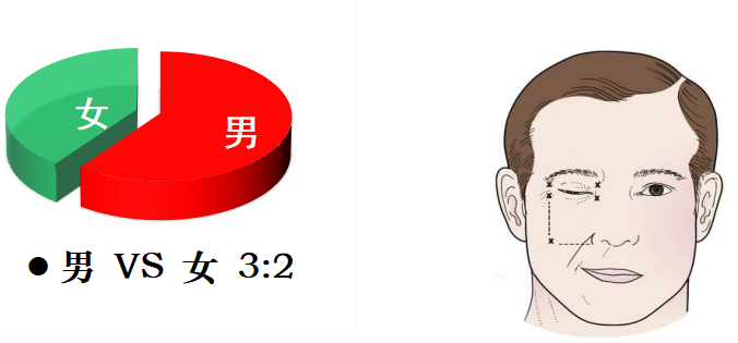 左跳財(cái)，右跳災(zāi)？眼皮跳的吉兇大解密→