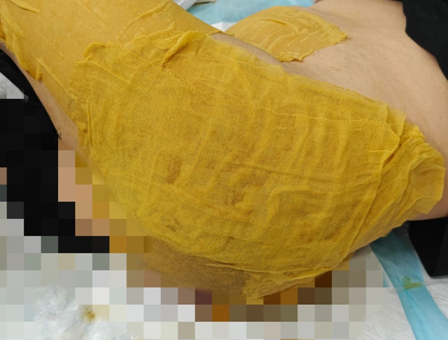【圍觀】毒蛇鉆進女子被窩，先咬PP后鎖喉...…