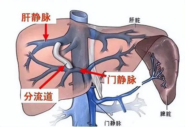 【警惕】大叔嘔吐鮮血2000ml，最終……