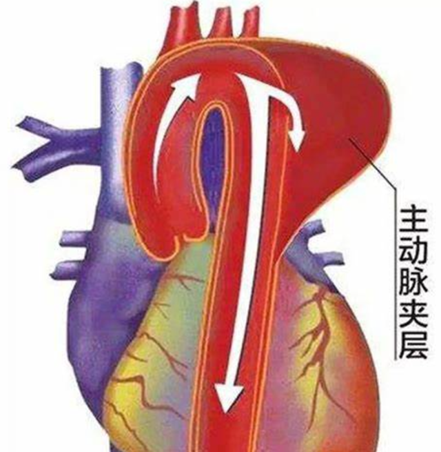 【警惕】冬季高發(fā)，男子倒地不起：“痛到像整個人被撕開！”