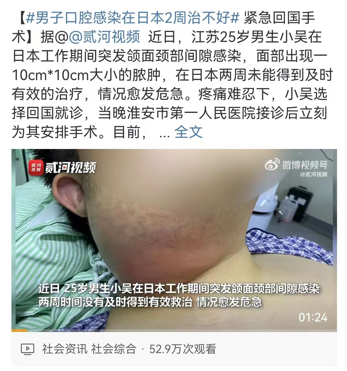 【圍觀】瀘州女子半邊臉腫成球！當(dāng)天“切開(kāi)”……