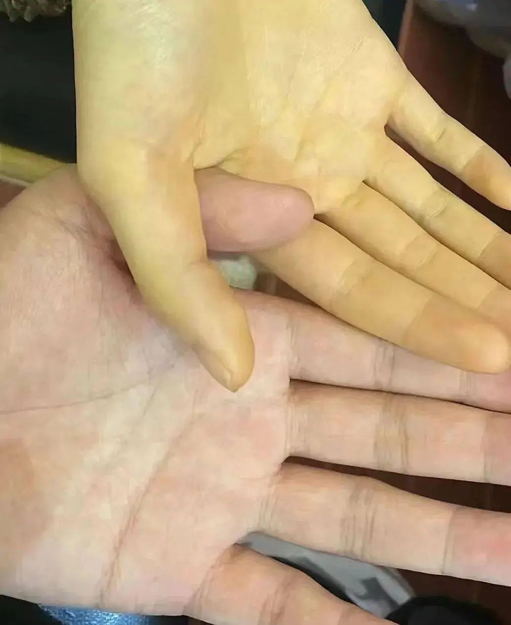 【警惕】這個(gè)水果每天最多吃5個(gè)，吃多了真的要變黃
