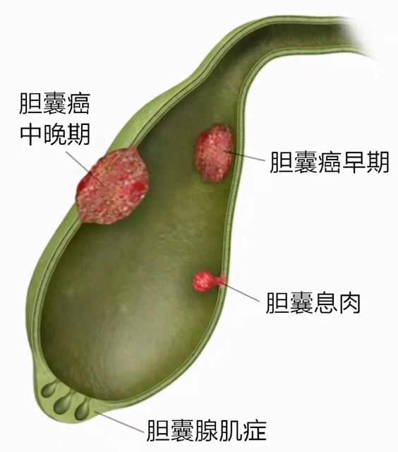 護(hù)士4.jpg