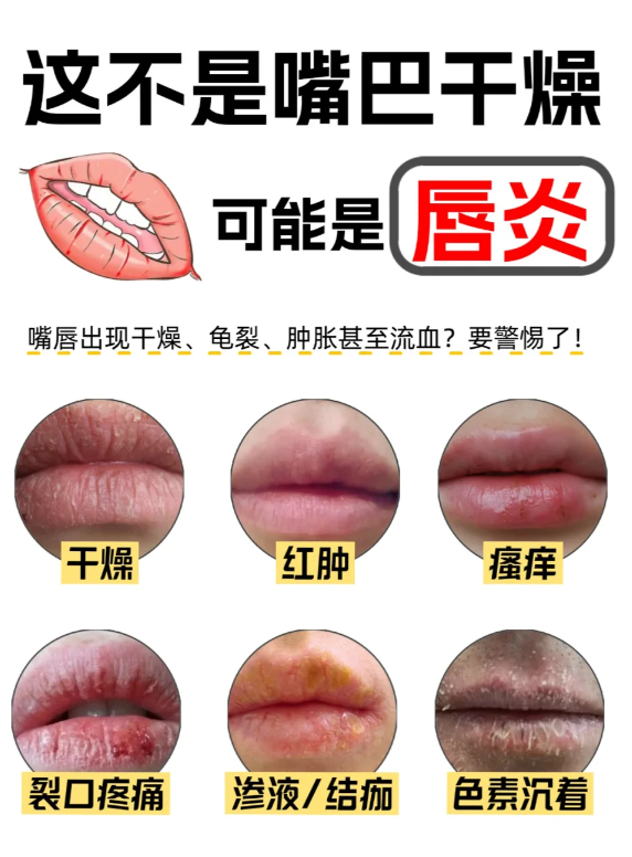 風(fēng)２.png