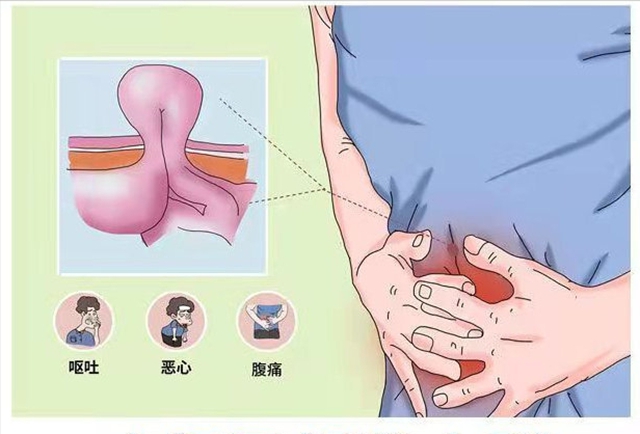 【關(guān)注】大爺肚子鼓起半個(gè)“足球”大包，竟是……