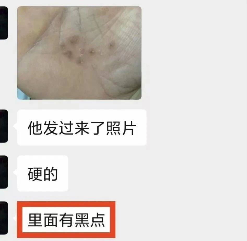 瀘州男子手上長(zhǎng)出……