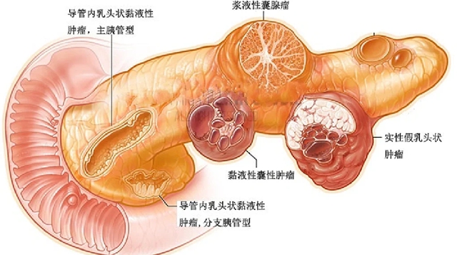 信號(hào)２.jpg