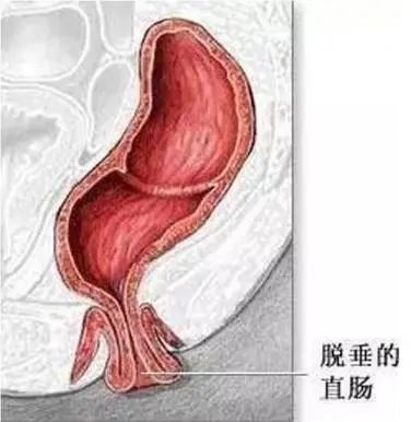 拉2.jpg
