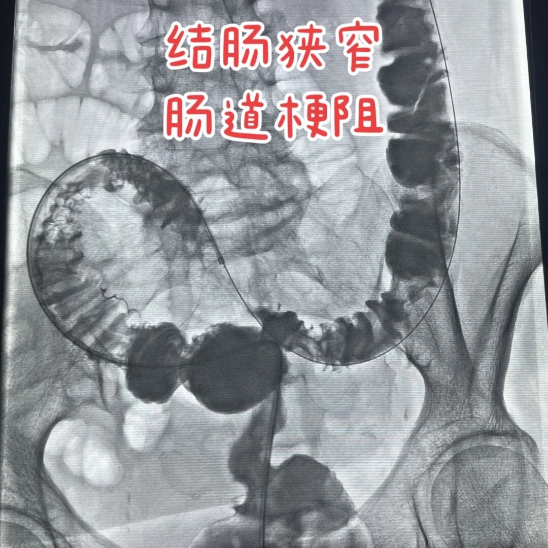 血2.jpg