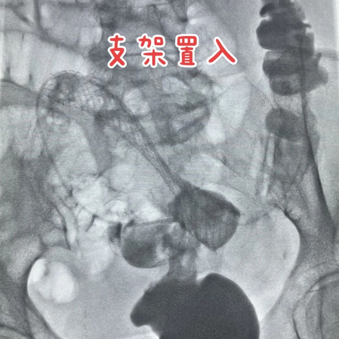 血4.jpg