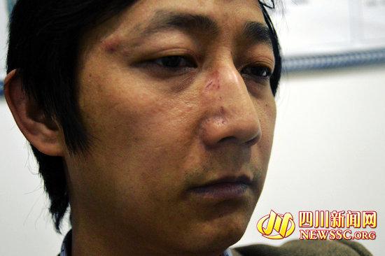 瀘州西南商貿(mào)城火災(zāi) 四川新聞網(wǎng)記者采訪被打(圖2)