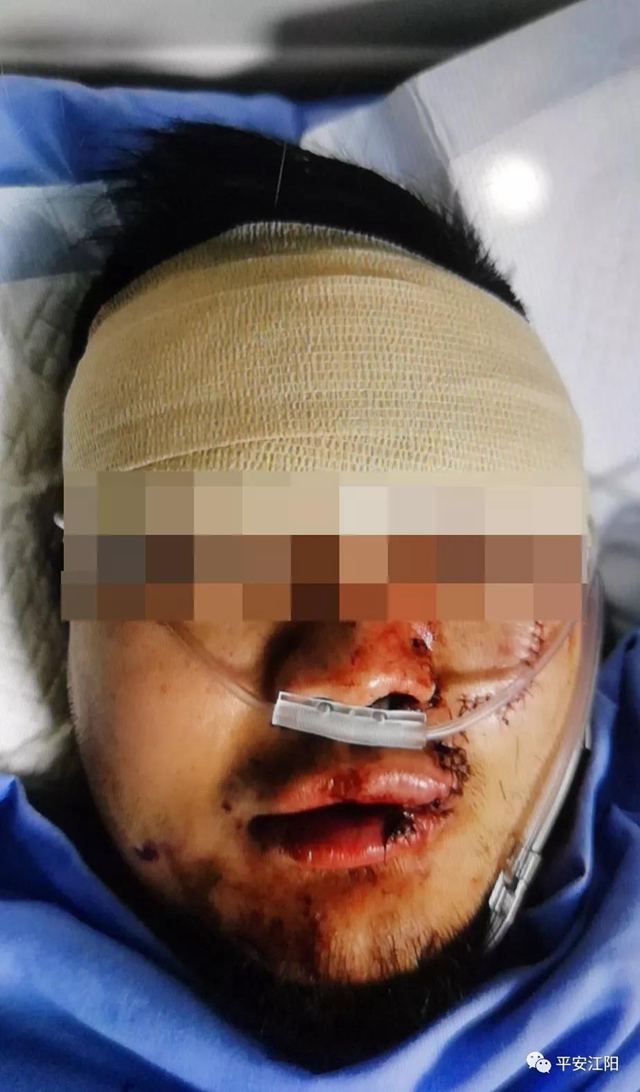 警方發(fā)布：匯通超市不戴口罩打人男子已到案 被抓時躺醫(yī)院臉縫數(shù)針……(圖5)