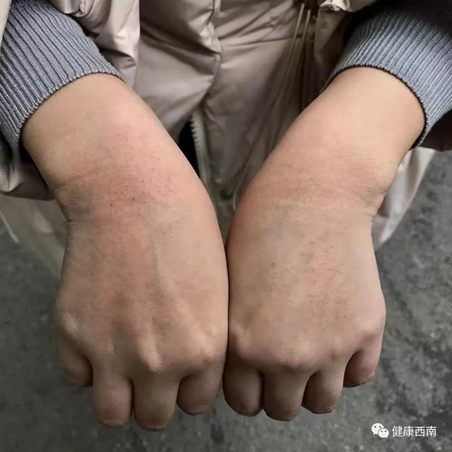 西南醫(yī)大附院援鄂日志：等戰(zhàn)“疫”勝利了，我們?nèi)コ詿岣擅妫?圖8)