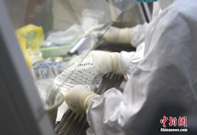 九問(wèn)新型冠狀病毒：新病毒比SARS“狡猾”在哪兒？(圖3)
