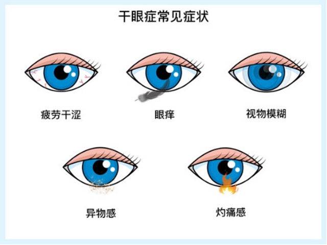 西南醫(yī)大附院專家提醒：抗擊新冠家里蹲，護(hù)眼常識(shí)需謹(jǐn)遵