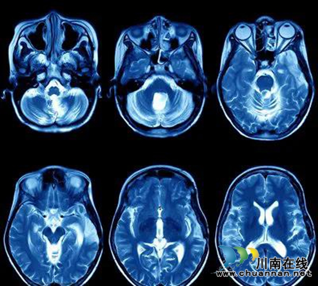 它來啦！“這個(gè)大物件”即將在瀘州骨病醫(yī)院投入使用(圖4)