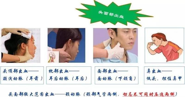 【關(guān)注】七旬婆婆意外摔傷頭部，流血不止……(圖4)