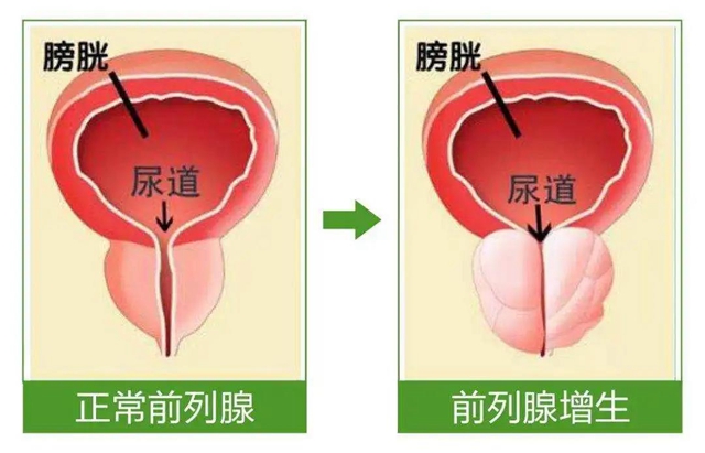 【關注】93歲大爺?shù)摹澳小毖灾[？差點……(圖7)