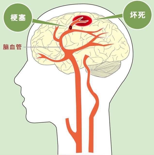 【冬季高發(fā)】6個危險信號一定要警惕！(圖4)