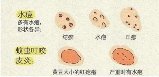 川南學生家長速看：當前已進入水痘高發(fā)期！(圖4)