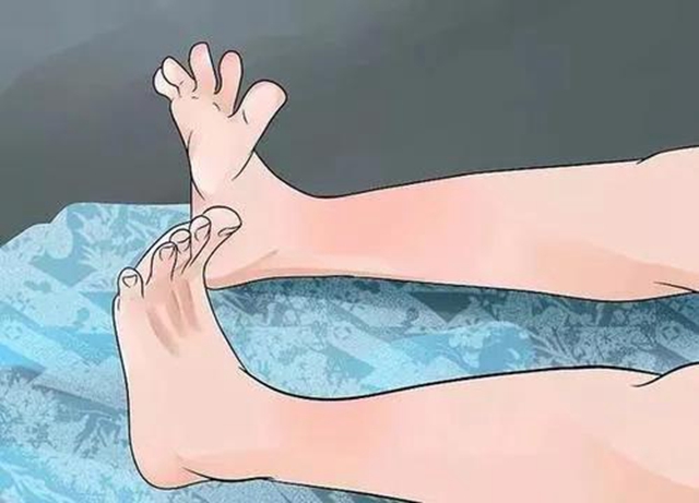 【關(guān)注】小腿突然抽筋，可不僅是缺鈣！(圖2)