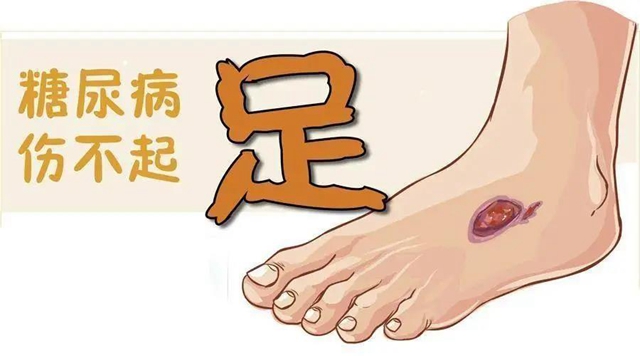 【擴(kuò)散】腳指甲剪很短，感覺很爽？！代價(jià)卻很……(圖4)