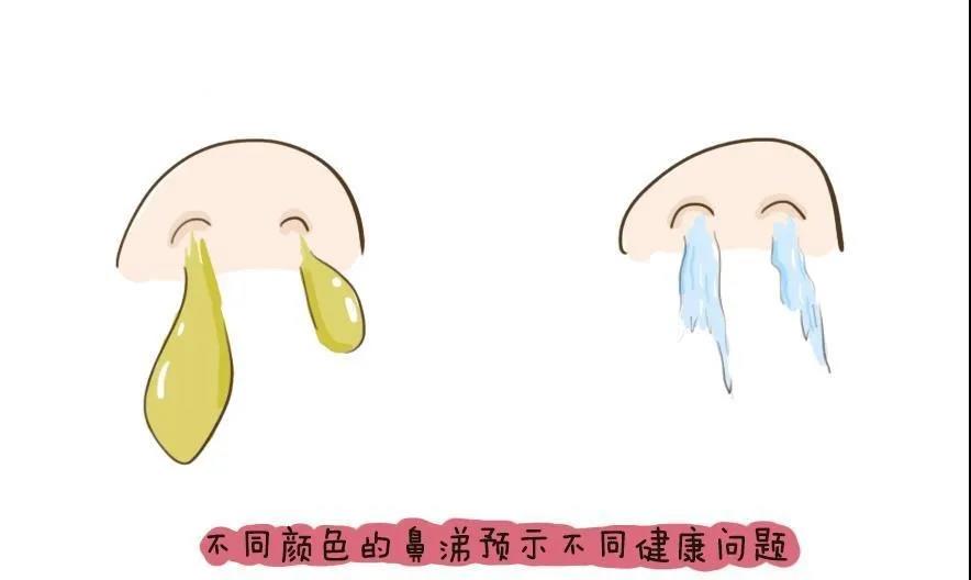 【擴(kuò)散】流鼻涕≠感冒，出現(xiàn)這些顏色的鼻涕要當(dāng)心！(圖4)