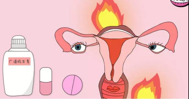 【關(guān)注】女性私處千萬(wàn)別過(guò)度清潔，可能會(huì)……(圖5)
