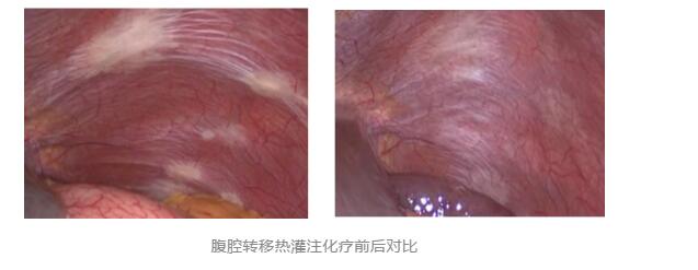 【關(guān)注】43℃高溫下，被燙死了……(圖8)