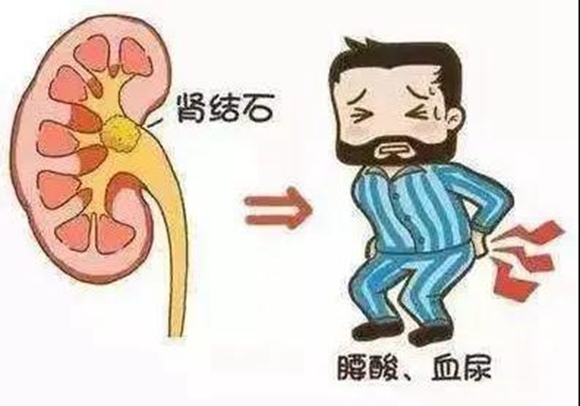 【圍觀】“植物偉哥”——秋葵，吃了真的能壯陽？(圖6)