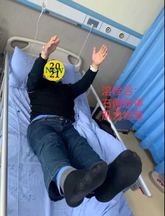 轉發(fā)可以救命！中風急救，抓住黃金4.5小時(圖2)