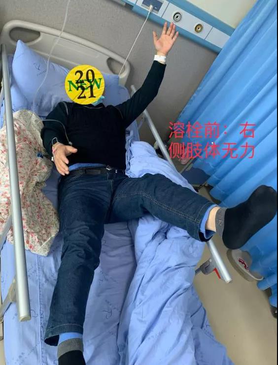 轉(zhuǎn)發(fā)可以救命！中風(fēng)急救，抓住黃金4.5小時(shí)